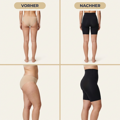 Vier Aufnahmen: Rück- und Seitenansicht, je einmal ohne und einmal mit dem Body Shaper