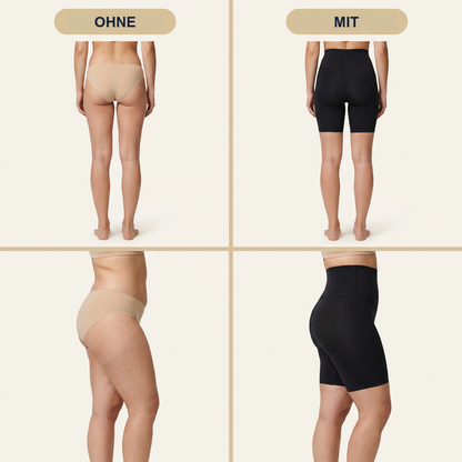 Vier Aufnahmen: Rück- und Seitenansicht, je einmal ohne und einmal mit dem Body Shaper